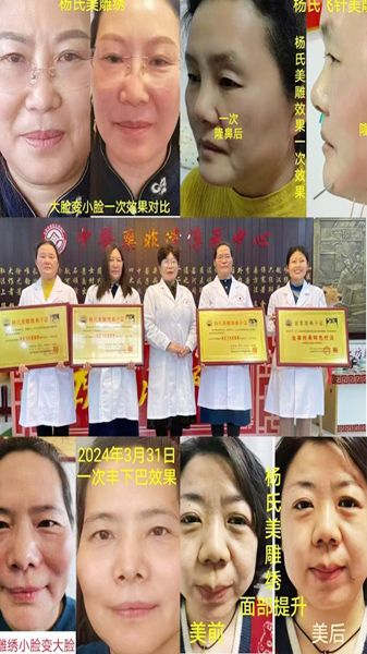 優(yōu) 秀學員事例(濰坊奎文區(qū)陳愛菊)